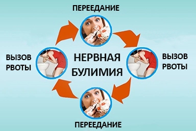 Лечение булимии в Киргиз-Мияках